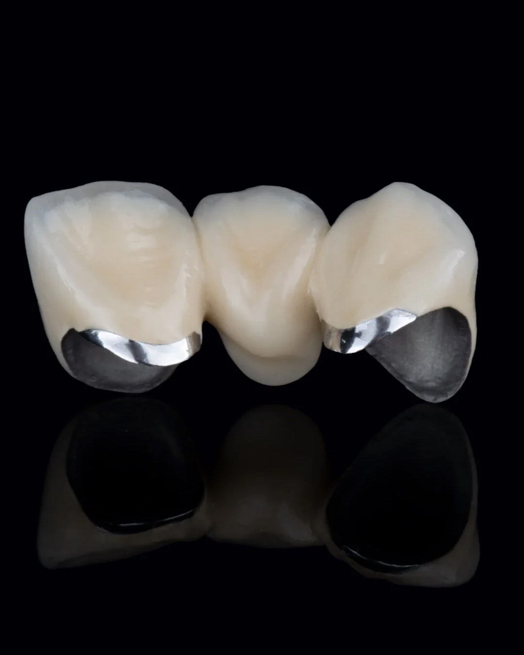 PFM Noble Metal CAD CAM – Esthetic Dental Laboratory